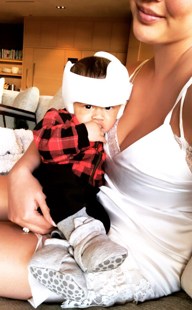 Chrissy Teigen S Son Wears Helmet For His Slightly Misshapen Head E Online